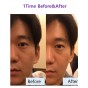 Hifu Lifting Mist