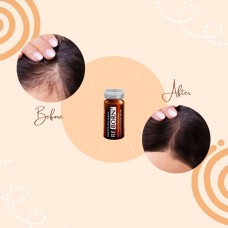 Sunki Hair Follicle Reborn Serum (BTCNS™)